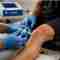 Ozone Therapy for Athletes